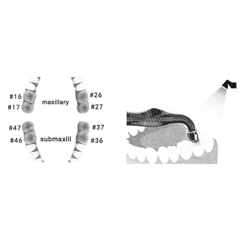 Dental Orthodontic Posterior T - 3D Printing Orthodontics 리뷰 및 가격