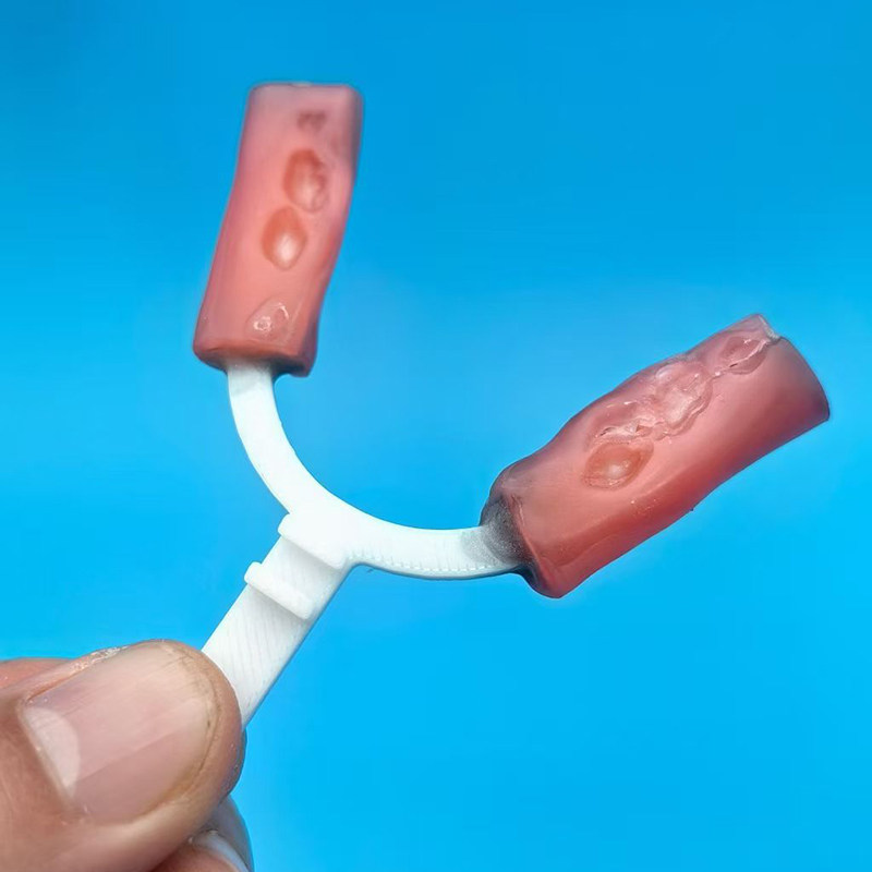 10Pcs/Bag Dental Bite Fork Ort - 3D Printing Orthodontics 리뷰 및 가격